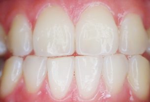 zęby, dbanie o zęby, wizyty u dentysty