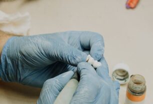 Ile lat wytrzymują implanty zębowe?